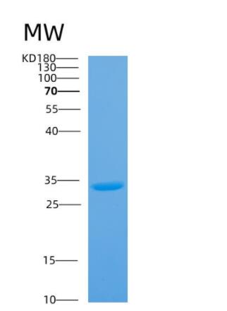 Recombinant Mycobacterium tuberculosisAntigen 85A Protein