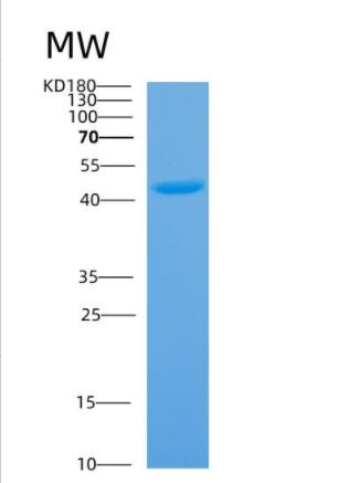 Recombinant Mouse Anxa1 Protein