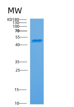 Recombinant Human ARC Protein