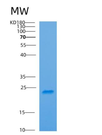 Recombinant Human ARF6 Protein