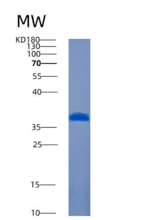 Recombinant Human AMMECR1L Protein