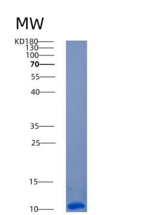 Recombinant Human ANAPC13 Protein