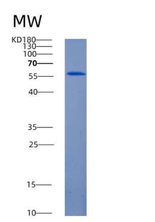 Recombinant Human ANGPT1 Protein