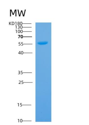 Recombinant Human ANXA11 Protein