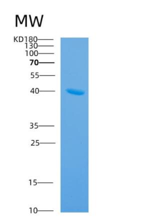 Recombinant Human ANXA8L2 Protein