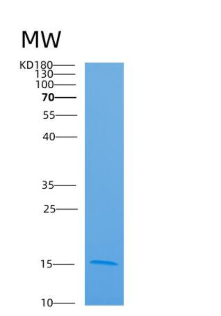 Recombinant Human ARL9 Protein