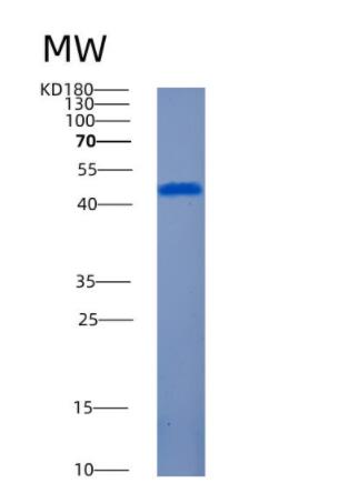 Recombinant Human AMT Protein