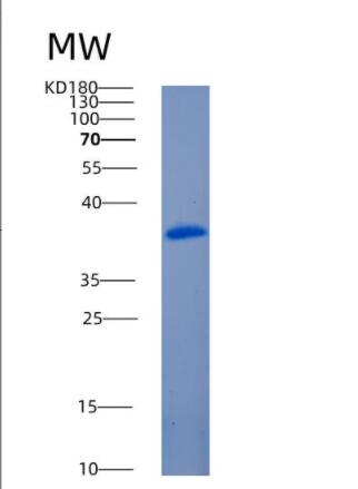 Recombinant Human Annexin A1 Protein