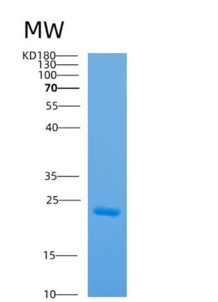 Recombinant Human AP3S1 Protein