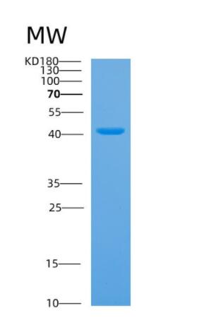 Recombinant Human ARHGEF39 Protein