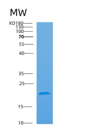 Recombinant Human ARL2BP Protein