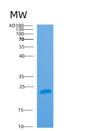 Recombinant Human ARL5B Protein