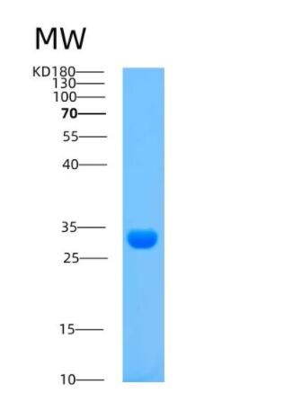 Recombinant Human ARPC3 Protein