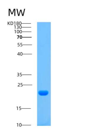 Recombinant Human ARPC5 Protein