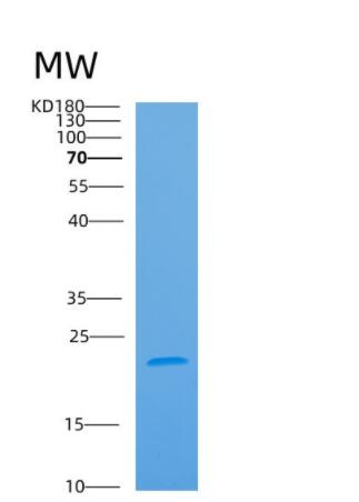 Recombinant Human ARL3 Protein