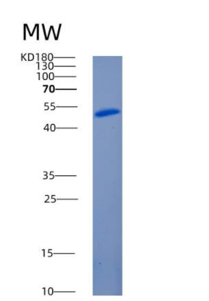 Recombinant Human ANGPTL3 Protein