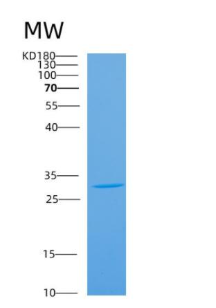 Recombinant Mouse Antxr2 Protein