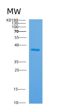 Recombinant Human APEX1 Protein