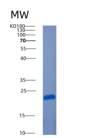 Recombinant Human AMTN Protein