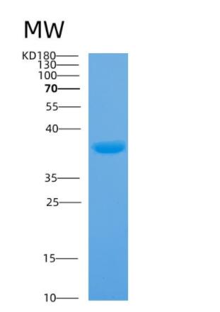 Recombinant Human Annexin A4 Protein