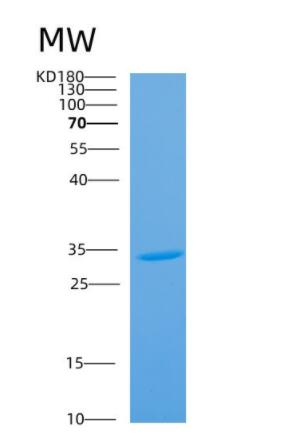 Recombinant Human ANTXR2 Protein