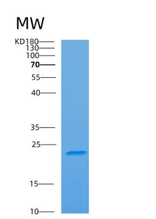 Recombinant Human ARF4 Protein