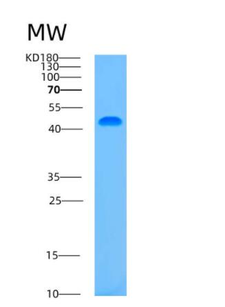 Recombinant Human ASCC1 Protein