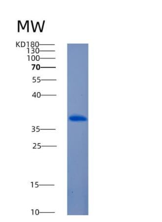 Recombinant Mouse Angiopoietin-related protein 7 Protein