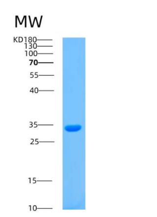 Recombinant Human ASB8 Protein