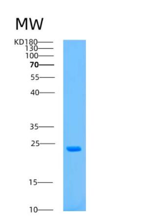 Recombinant Human ASPH Protein