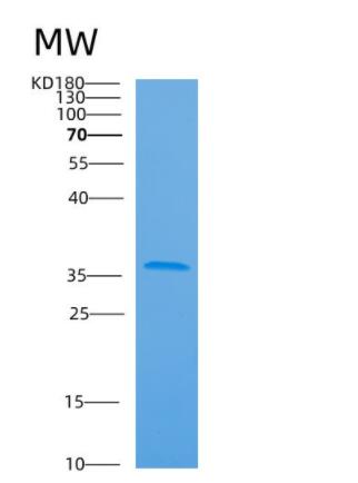 Recombinant Human ARPC2 Protein