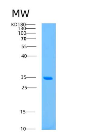 Recombinant Human ASRGL1 Protein