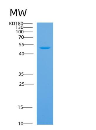 Recombinant Human ANXA7 Protein