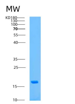 Recombinant Human ASPRV1 Protein