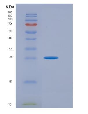 Recombinant Activating Transcription Factor 1 (ATF1)