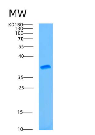 Recombinant Human ATG3 Protein