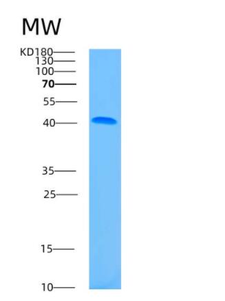 Recombinant Human ASNA1 Protein