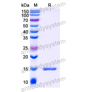 Anti-Human VIM/Vimentin Nanobody (SAA1226)