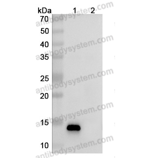 中和抗体-Human CCL2/MCP-1 (Iv0077) VHC97801