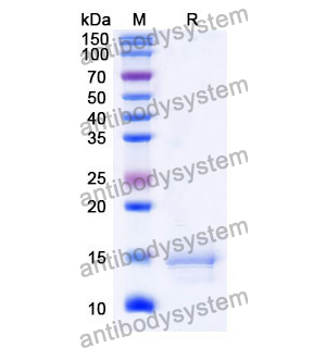 Anti-Human CCL2/MCP-1 Nanobody (SAA1269)