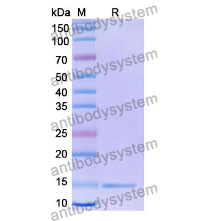 Anti-Human CD132/IL2RG Nanobody (SAA1050)