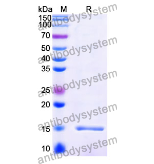 Anti-Vibrio cholerae serotype O1 higB-2 Nanobody (SAA1035)