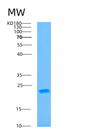 Recombinant Human B9D2 Protein