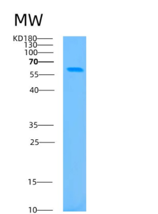 Recombinant Human BAIAP2 Protein