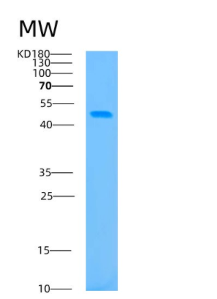 Recombinant Human BCAT1 Protein