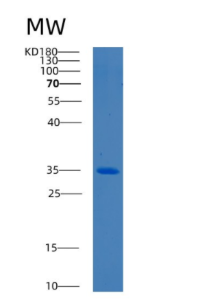 Recombinant Human BCDIN3D Protein