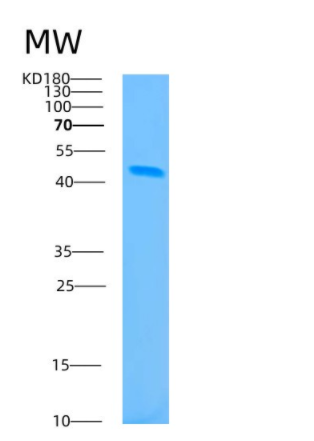 Recombinant Human B3GNT2 Protein