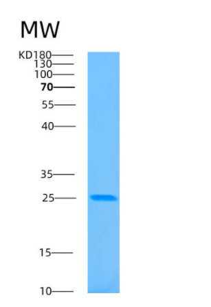 Recombinant Human BASP1 Protein