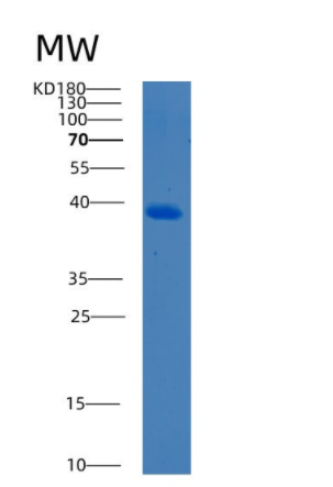 Recombinant Human BCCIP Protein