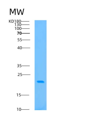 Recombinant Human BAP18 Protein